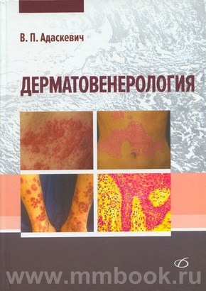 Дерматовенерология