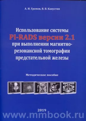 Использование системы PI-RADS версии 2.1 при выполнении магнитно-резонансной томографии предстательной железы
