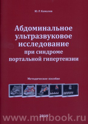 Абдоминальное ультразвуковое исследование при синдроме портальной гипертензии. Методическое пособие