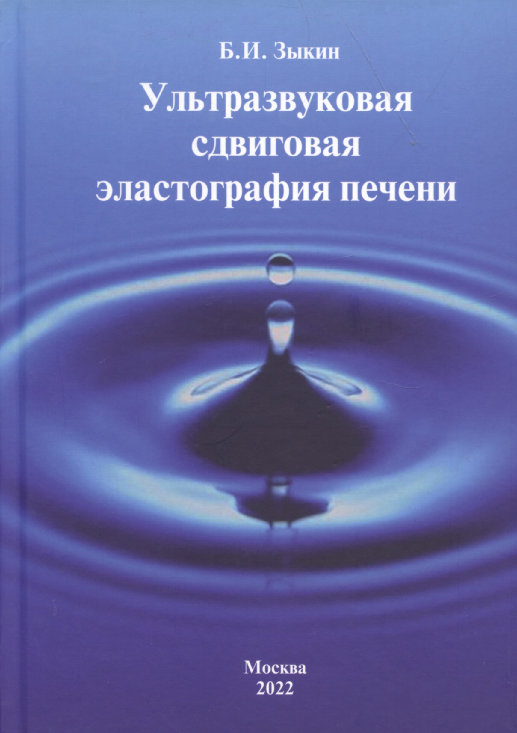 Ультразвуковая сдвиговая эластография печени