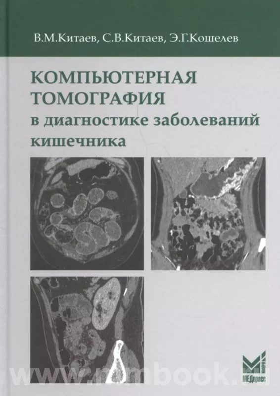 Компьютерная томография в диагностике заболеваний кишечника