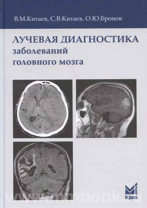 Лучевая диагностика заболеваний головного мозга