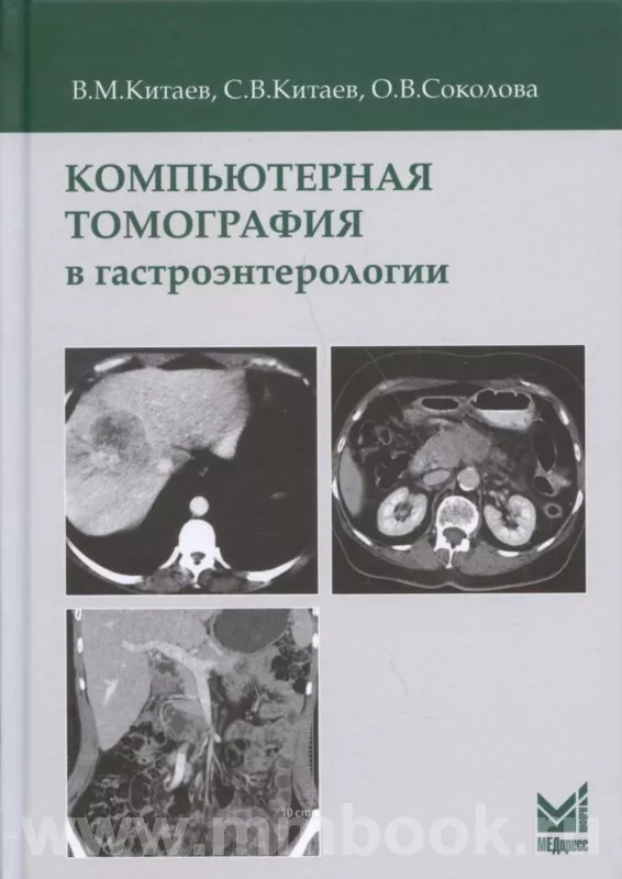 Компьютерная томография в гастроэнтерологии: руководство для врачей