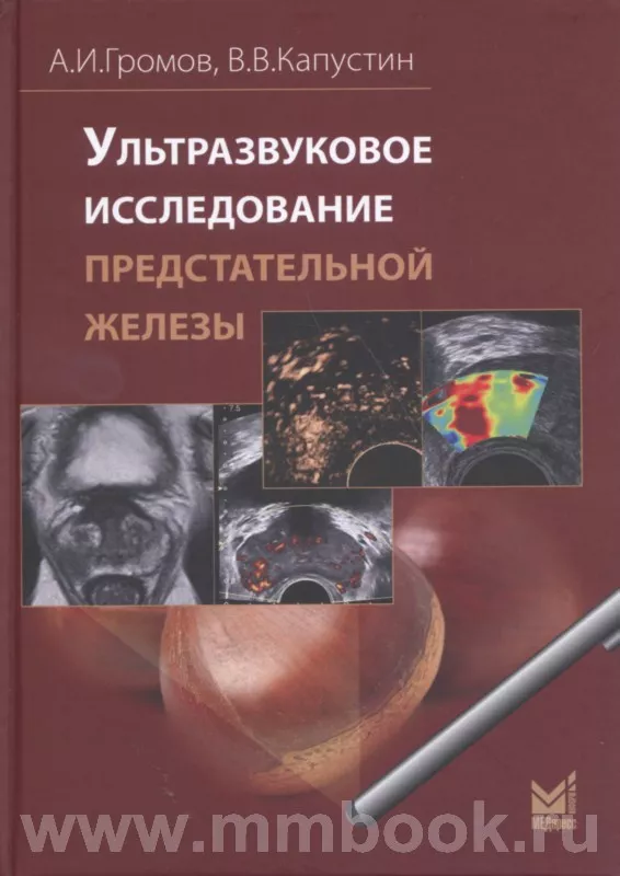 Ультразвуковое исследование предстательной железы