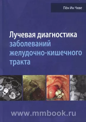 Лучевая диагностика заболеваний желудочно-кишечного тракта