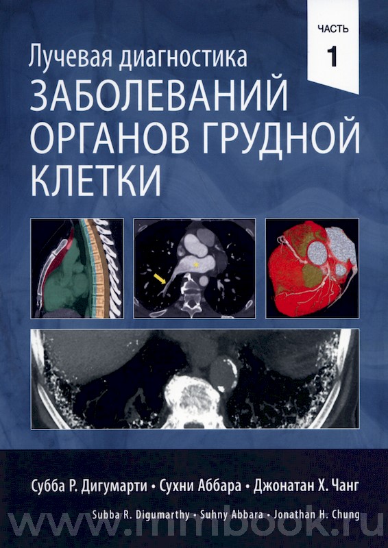 Лучевая диагностика заболеваний органов грудной клетки