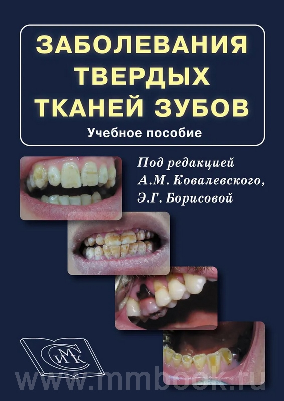 Заболевания твёрдых тканей зубов. Учебное пособие