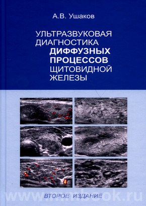 Ушаков А.В. - Ультразвуковая диагностика диффузных процессов щитовидной железы