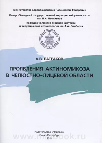 Проявления актиномикоза в челюстно-лицевой области