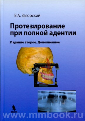 Протезирование при полной адентии