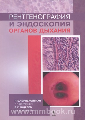 Рентгенография и эндоскопия органов дыхания: Учебн. пособие 