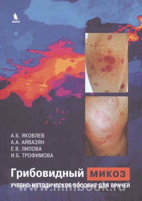 Грибовидный микоз