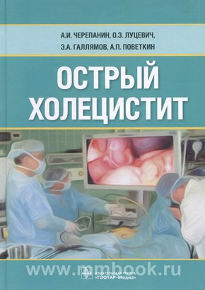 Острый холецистит