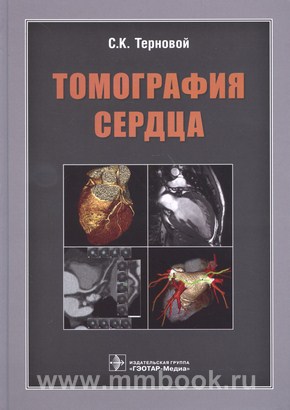 Терновой С. К. - Томография сердца