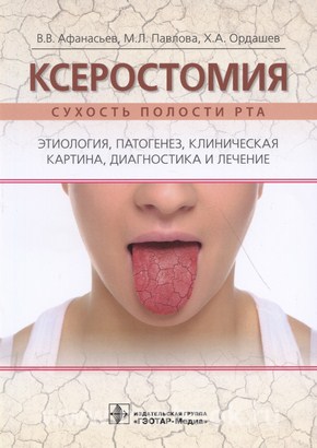 Ксеростомия (сухость полости рта). Этиология, патогенез, клиническая картина, диагностика и лечение