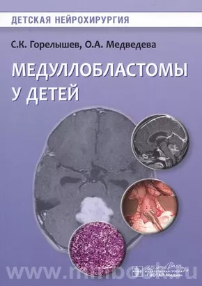 Медуллобластомы у детей