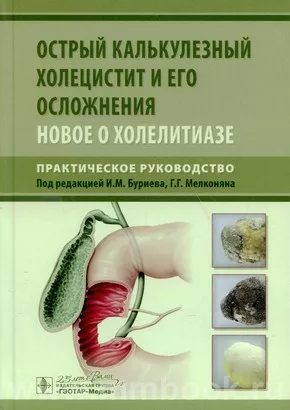 Острый калькулезный холецистит и его осложнения. Новое о холелитиазе. Практическое руководство 