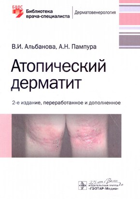 Атопический дерматит