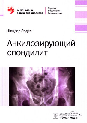 Анкилозирующий спондилит