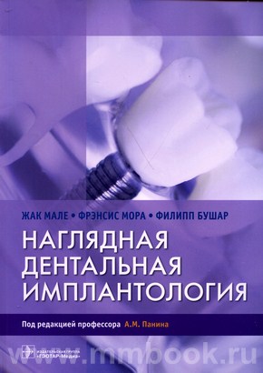 Наглядная дентальная имплантология