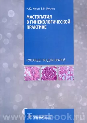Мастопатия в гинекологической практике : руководство для врачей