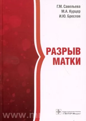 Разрыв матки