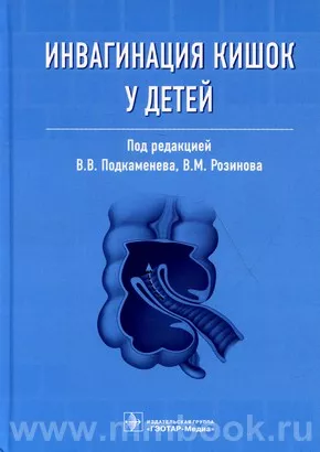 Инвагинация кишок у детей