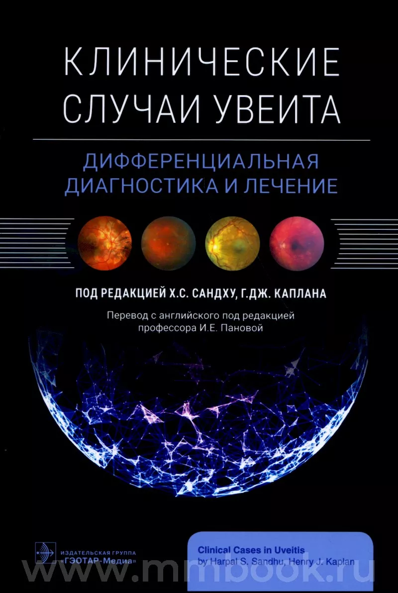 Клинические случаи увеита. Дифференциальная диагностика и лечение