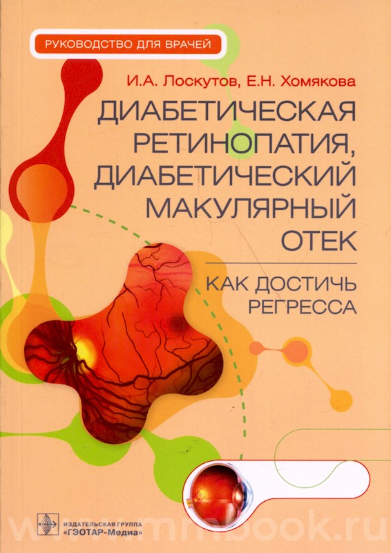 Диабетическая ретинопатия, диабетический макулярный отек — как достичь регресса : руководство для врачей