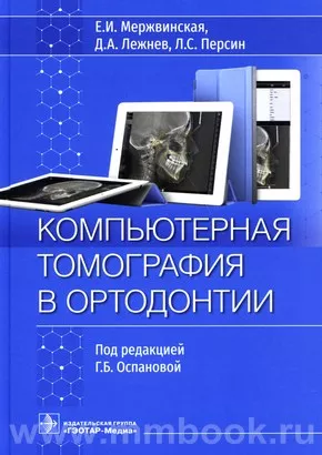 Компьютерная томография в ортодонтии