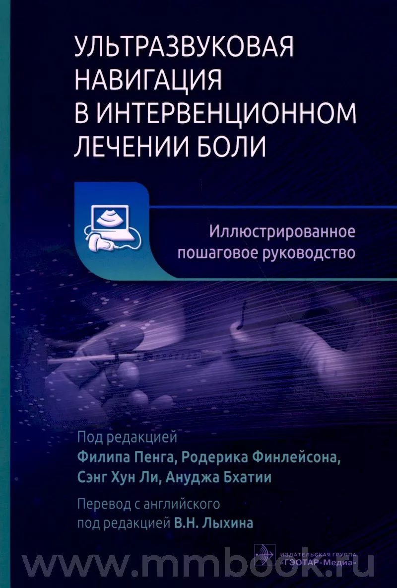 Ультразвуковая навигация в интервенционном лечении боли. Иллюстрированное пошаговое руководство