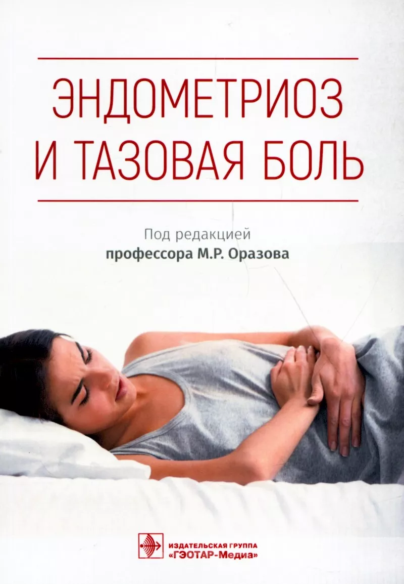 Эндометриоз и тазовая боль