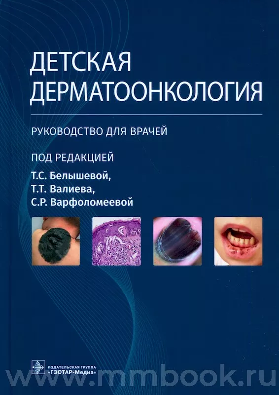 Детская дерматоонкология : руководство для врачей