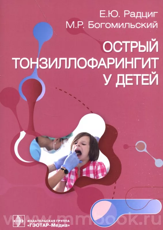 Острый тонзиллофарингит у детей