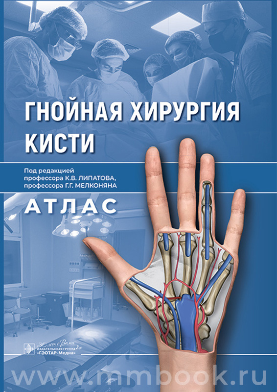 Гнойная хирургия кисти. Атлас