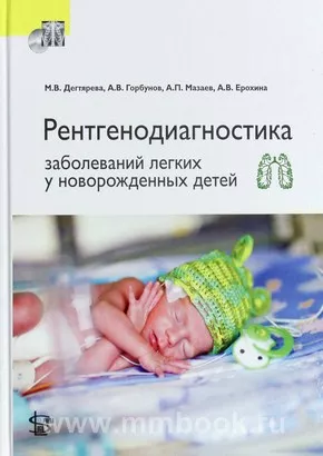 Рентгенодиагностика заболеваний легких у новорожденных детей