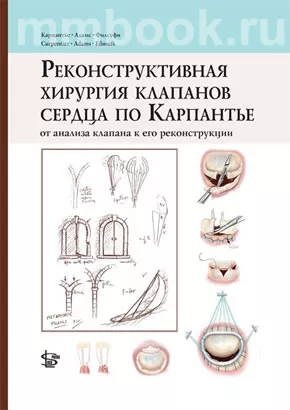 Реконструктивная хирургия клапанов сердца по Карпантье: от анализа клапана к его реконструкции
