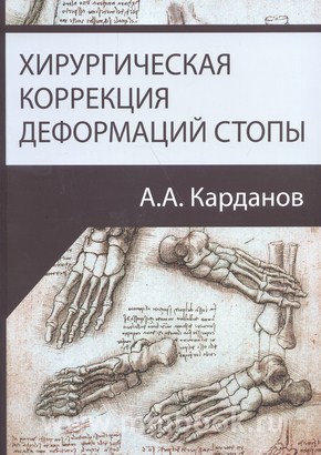 Хирургическая коррекция деформаций стопы.
