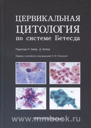 Цервикальная цитология по системе Бетесда. Терминология, критерии и пояснения