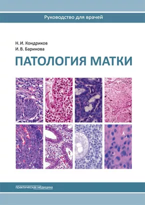 Патология матки. Иллюстрированное руководство