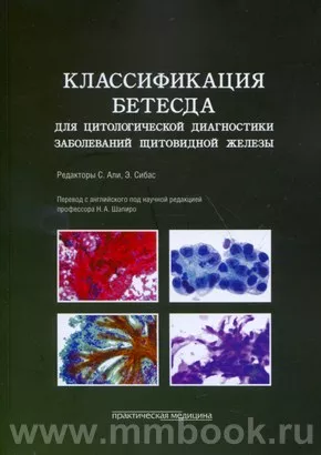 Классификация Бетесда для цитологической диагностики заболеваний щитовидной железы: терминология, критерии и пояснения