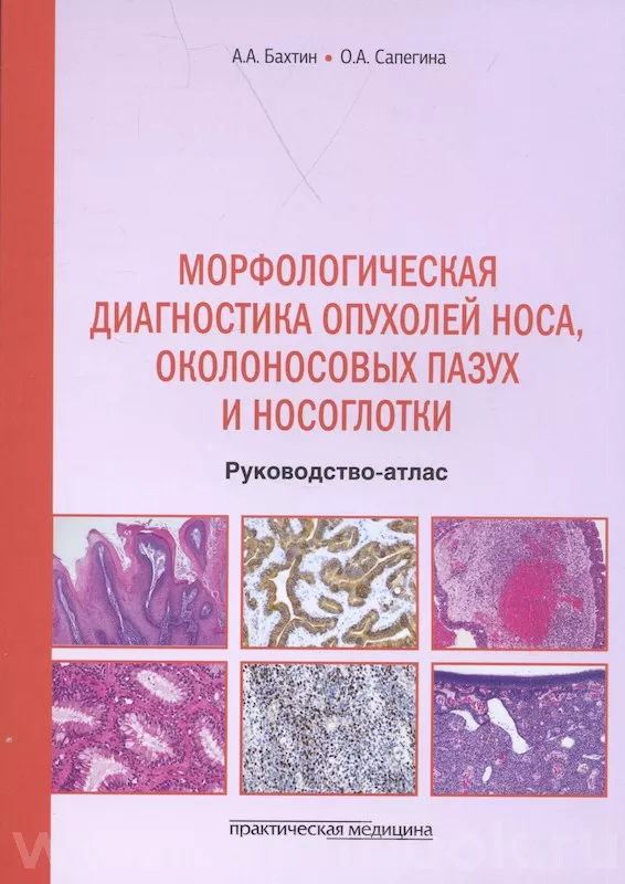 Морфологическая диагностика опухолей носа, околоносовых пазух и носоглотки : руководство-атлас