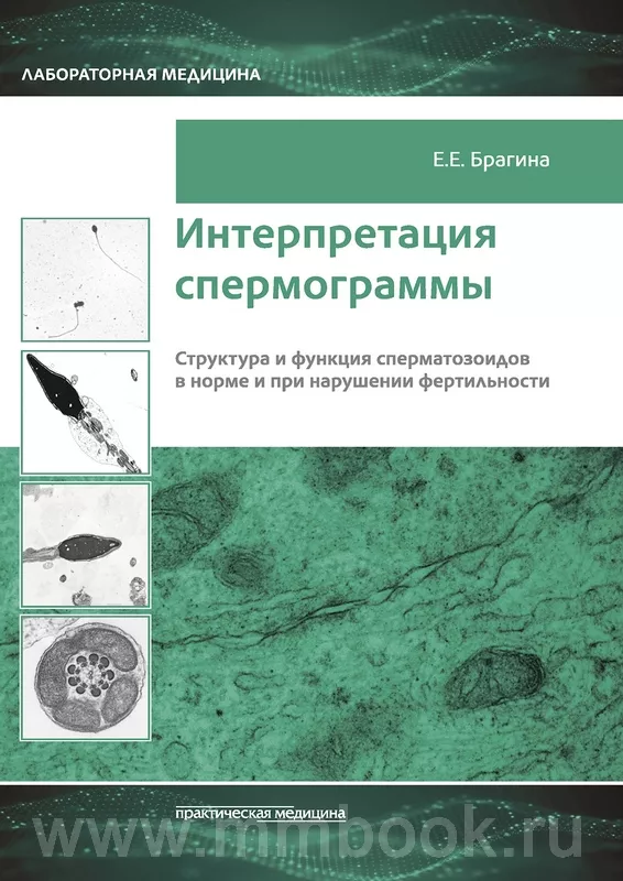 Интерпретация спермограммы. Структура и функция сперматозоидов в норме и при нарушении фертильности