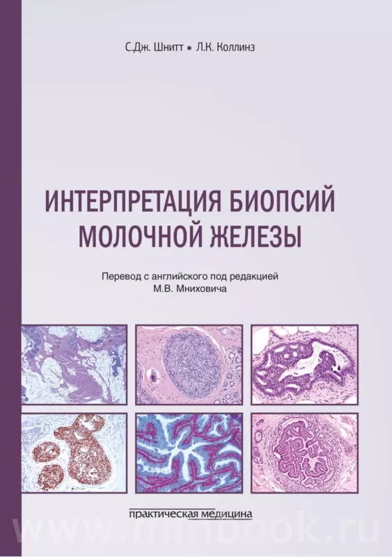 Интерпретация биопсий молочной железы