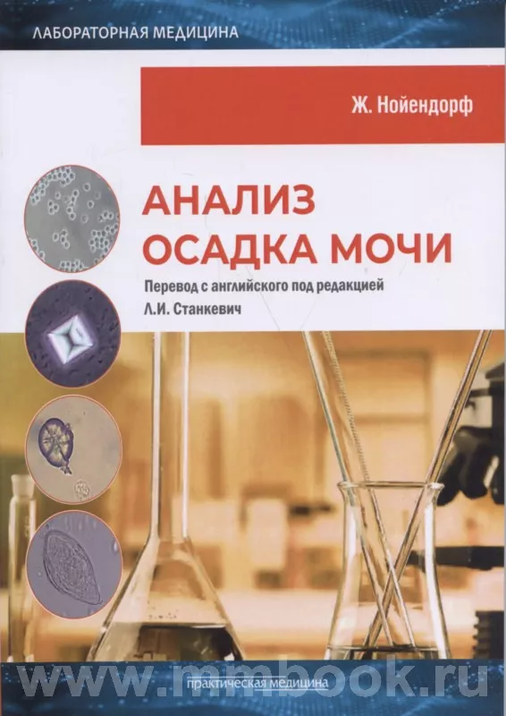 Анализ осадка мочи
