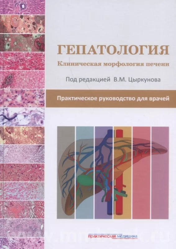 Гепатология. Клиническая морфология печени. Практическое руководство для врачей