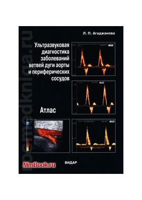 Ультразвуковая диагностика заболеваний ветвей дуги аорты и периферических сосудов 2-е издание на CD - диске