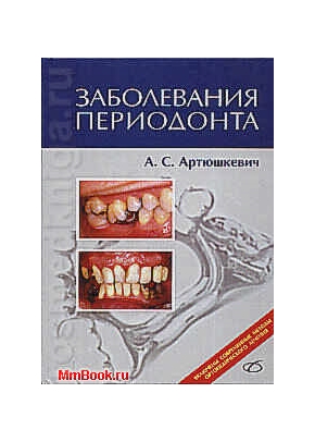 Заболевания периодонта