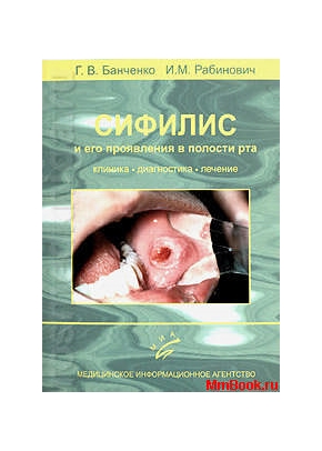 Сифилис и его проявления в полости рта. Клиника