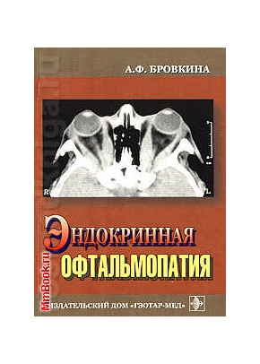 Эндокринная офтальмопатия